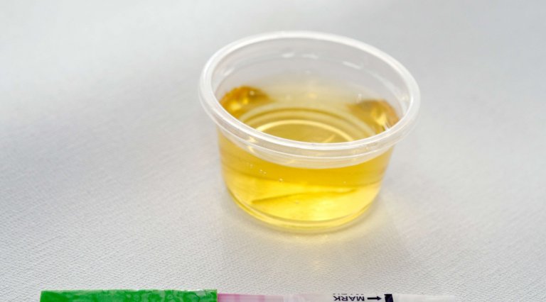 Stupéfiants: comment des justiciables contournent les tests d’urine
