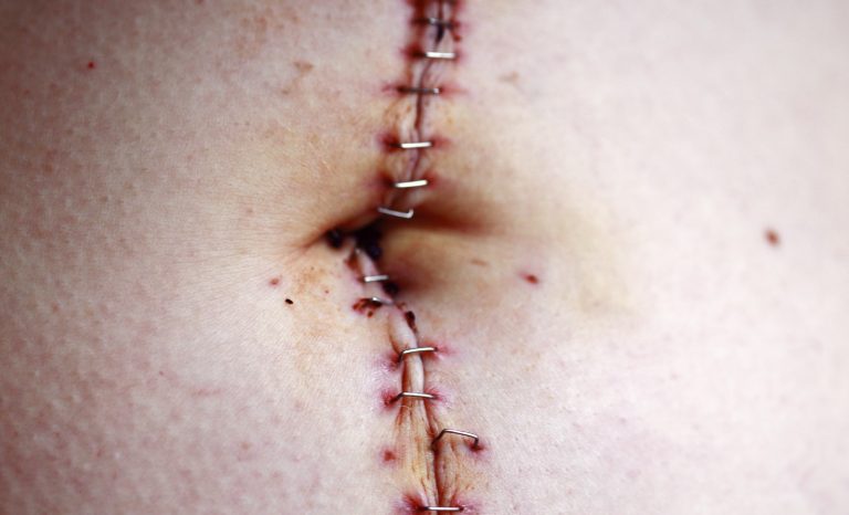 Mishima ou Montaigne?