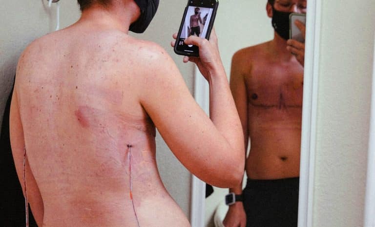 Transidentité: cette étude finlandaise qui chagrine les militants